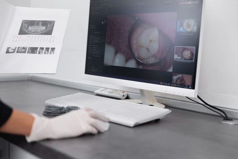 Ventajas de un software de odontología